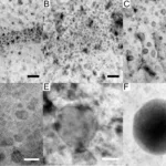 Figure 2: TEM images of pre compressed T6 Al7075 alloy. A) Linear band of GP zones. B) Cluster of GP zones. C) and D) Higher magnification TEM images of GP zone clusters showing the coherent interface between GP zones and Al matrix E and F ) Bright field TEM image of η phase MgZn 2 precipitate . Scale bars are 25 nm for A C , E and F, and 10 nm for D