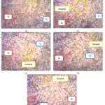 FIGURE 4. The microstructure of Al-Si with Nanoreinforced MnO, (a) Al-Si Raw Material, (b) Al-Si with Reinforced MnO Raw Material, (c) Al-Si with Nanoreinforeced MnO After Sintering 30 Minutes, (d) Al-Si with Nanoreinforced MnO After Sintering 60 Minutes and (e) Al-Si with Nanoreinforced MnO Doped Graphene Oxide.