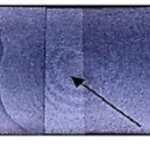 Fig. 10. Optical micrograph of an onion ring feature in FSW AA6061/Al2O3/20p crosssection [35].